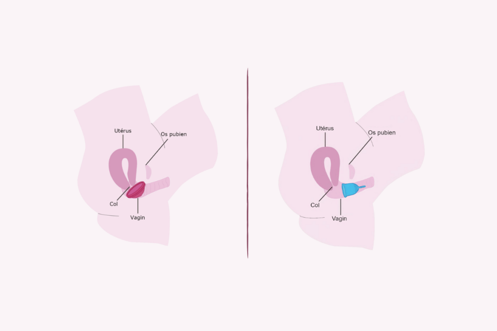 Positionnement de la cup/disque menstruel